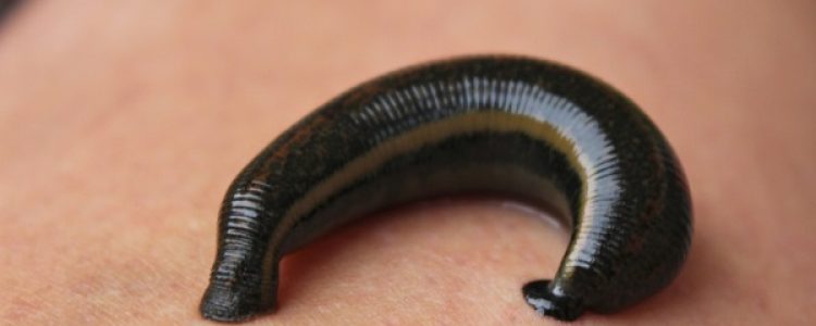Benefits of Medicinal Leeches, Leeches Therapy