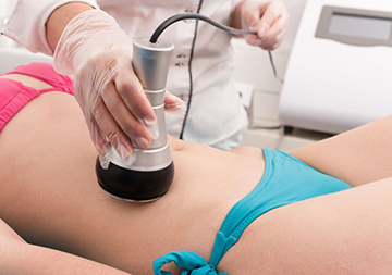 Ultrasound Cavitation